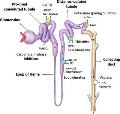 New Insights Into Diuretic Use to Treat Congestion in the ICU: Beyond Furosemide